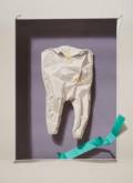 Yrjö Edelmann: Wrapped tooth		